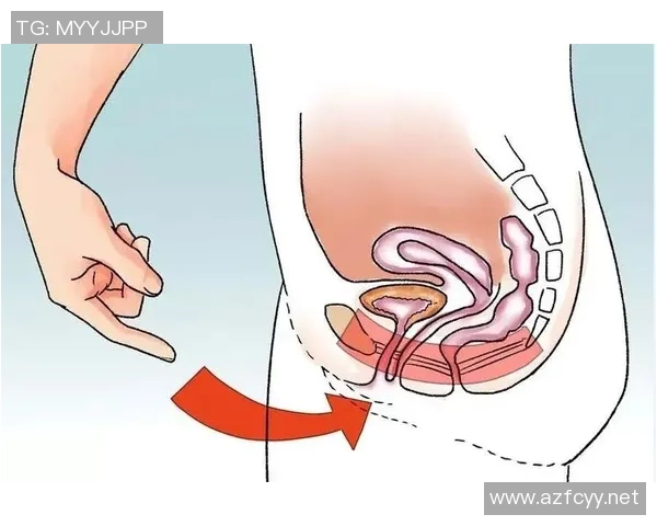 提升盆底健康 从凯格尔运动开始 让生活更加轻松自在